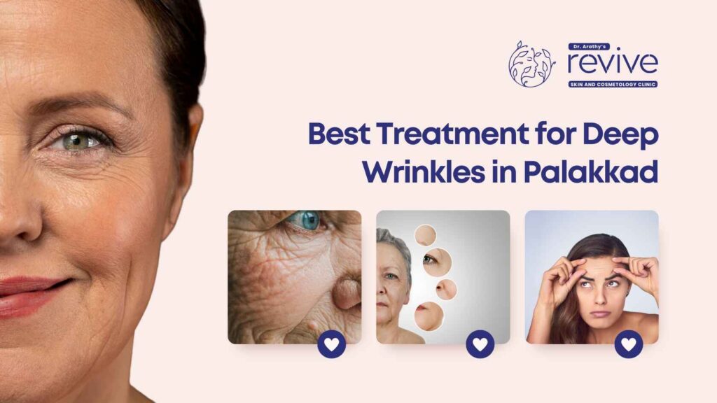 Best treatment for deep wrinkles in Palakkad at Dr. Arathy's Revive Skin & Cosmetology Clinic