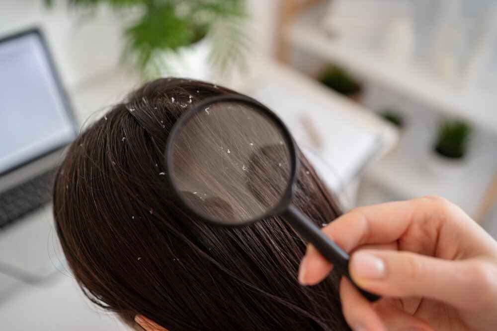 Revive Skin & Cosmetology Clinic in Palakkad, known for dandruff treatment