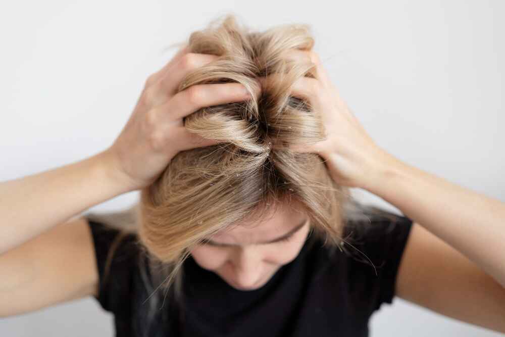 Patient receiving laser therapy for dandruff at Dr. Arathy's clinic