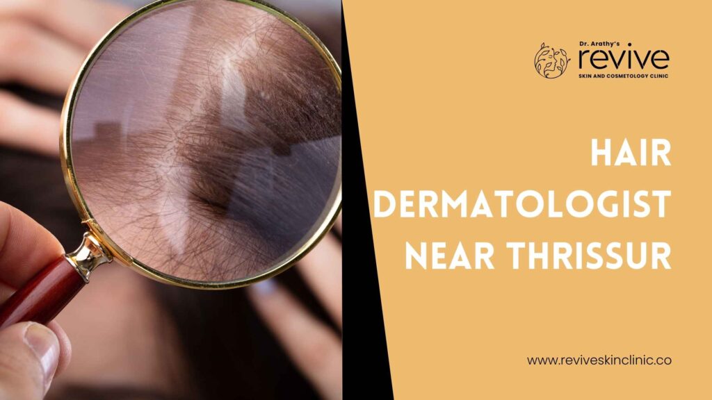 Hair Dermatologist Near Thrissur
