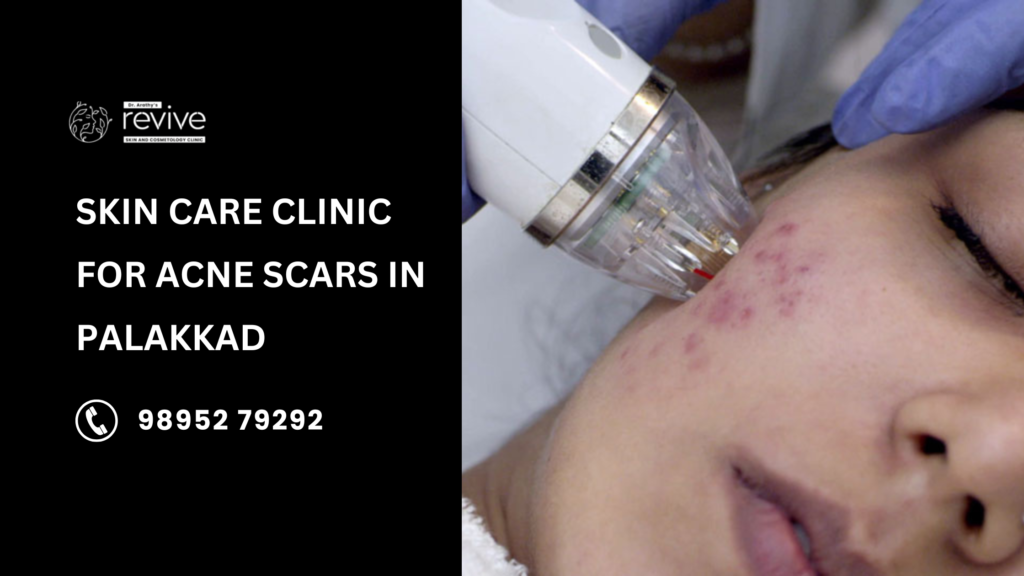 Best skin care clinic for acne scars in Palakkad – Dr. Arathy’s Revive Skin & Cosmetology Clinic offering advanced treatments like laser therapy, PRP, and chemical peels.
