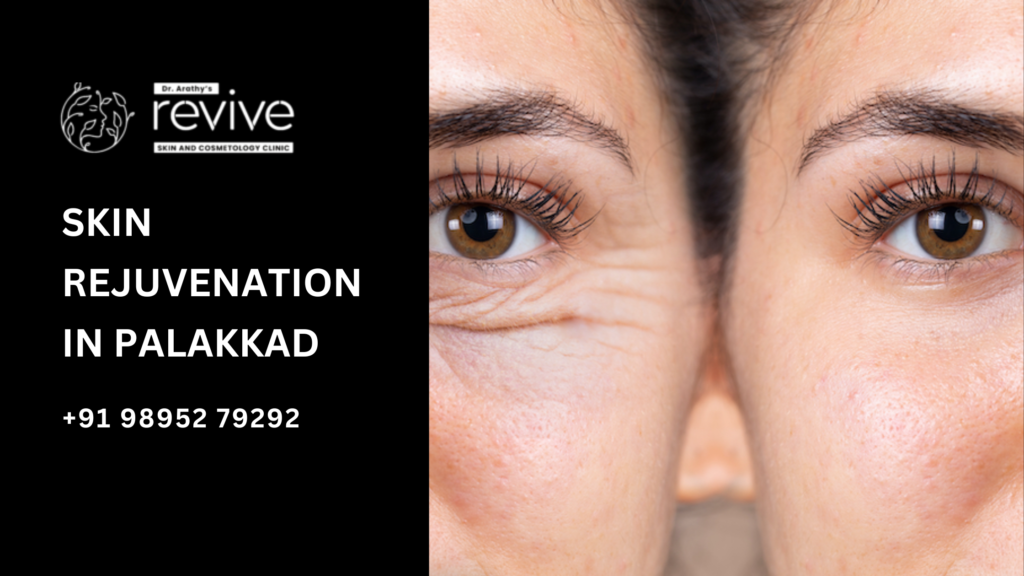 PRP therapy session at Dr. Arathy’s Revive Skin and Cosmetology Clinic in Palakkad, showcasing a specialist preparing platelet-rich plasma treatment for skin rejuvenation.