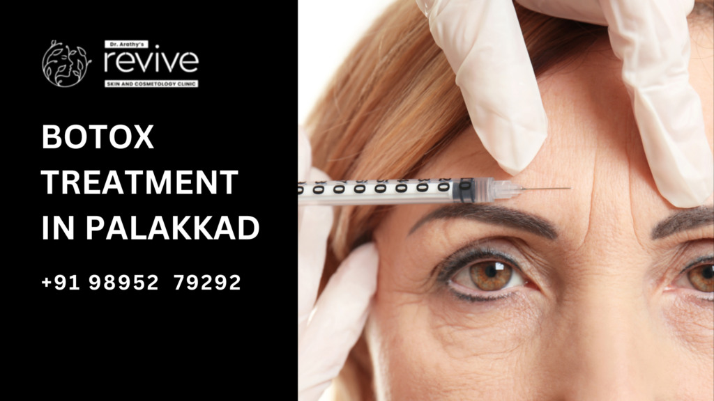 Botox treatment at Revive Skin & Cosmetology Clinic, Palakkad, by Dr. Arathy Jerald.