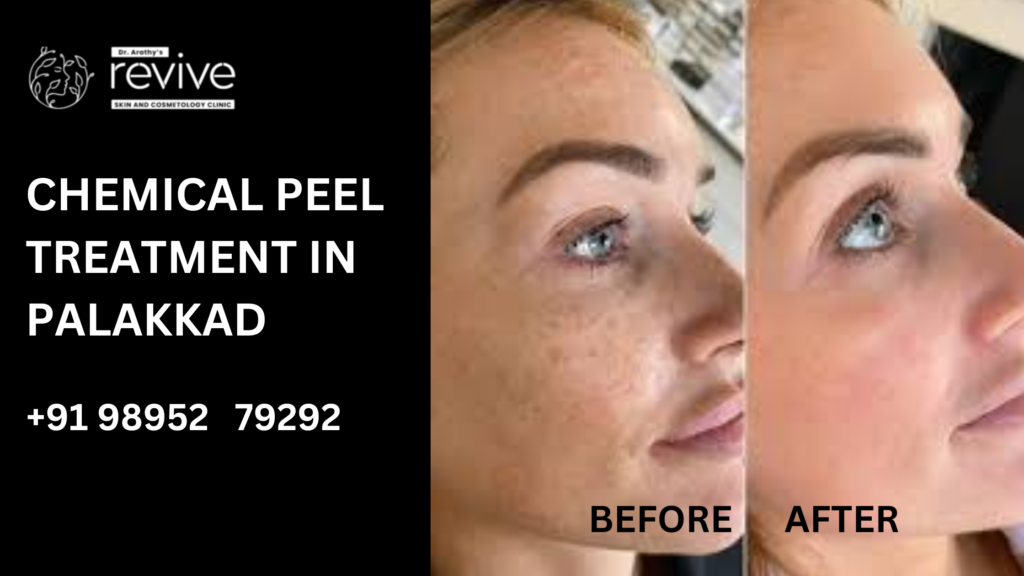A dermatologist performing a chemical peel on a patient's face.