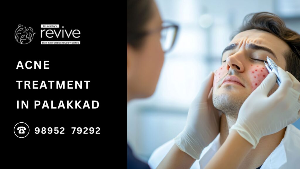 A professional consultation session at Revive Skin & Cosmetology Clinic in Palakkad, where Dr. Arathy Jerald provides personalized acne treatment solutions for clear and healthy skin.