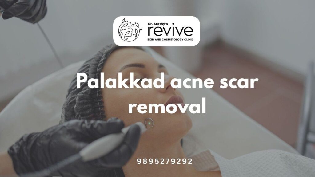 "Before and after results of Palakkad acne scar removal treatment at Dr. Arathy's Revive Skin & Cosmetology Clinic"