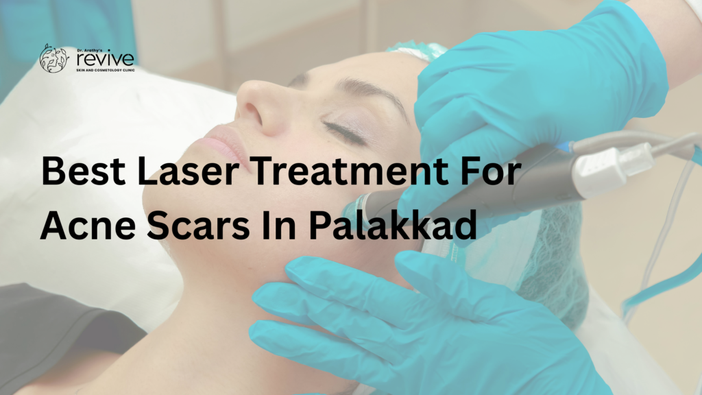 best laser treatment for acne scars in Palakkad