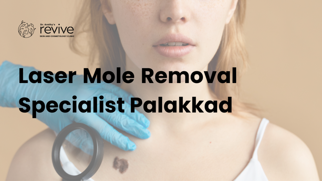 laser mole removal specialist Palakkad