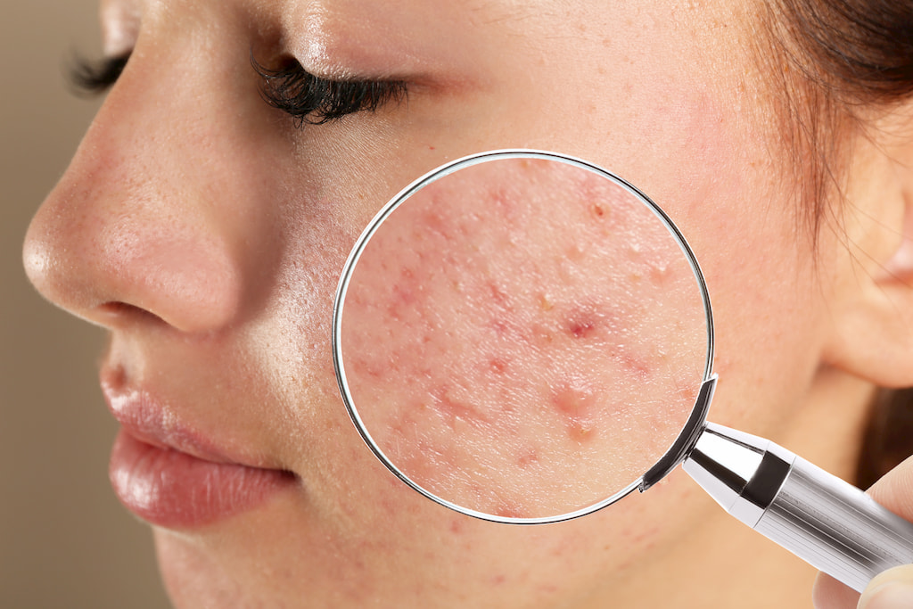 General Dermatology