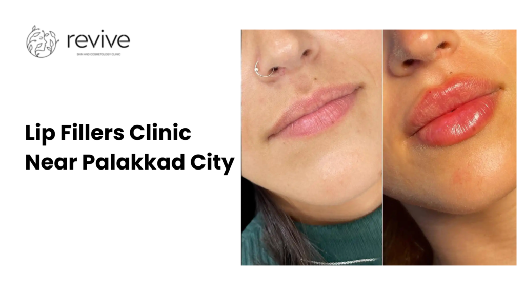 Dr. Arathy’s Revive Skin & Cosmetology Clinic – Lip Fillers Clinic Near Palakkad City