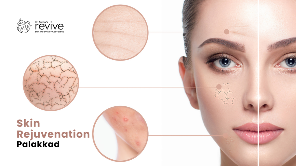 best clinic for skin rejuvenation Palakkad