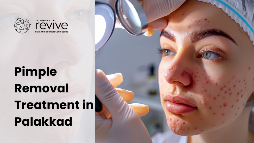 Pimple Removal Skinclinic Palakkad