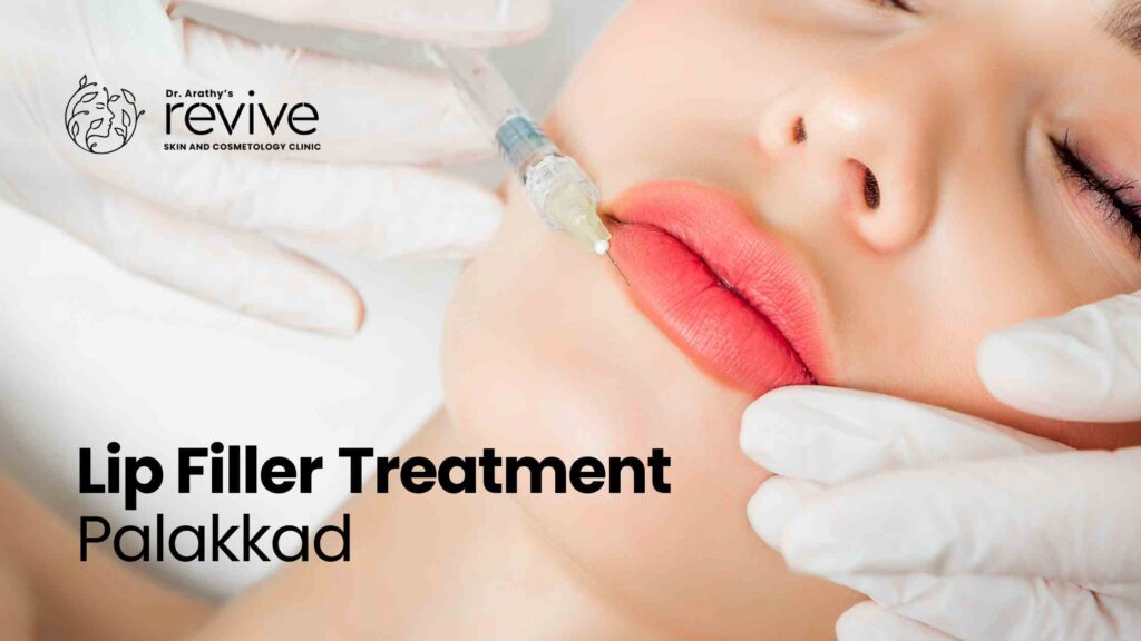 Lip Filler Treatment Palakkad