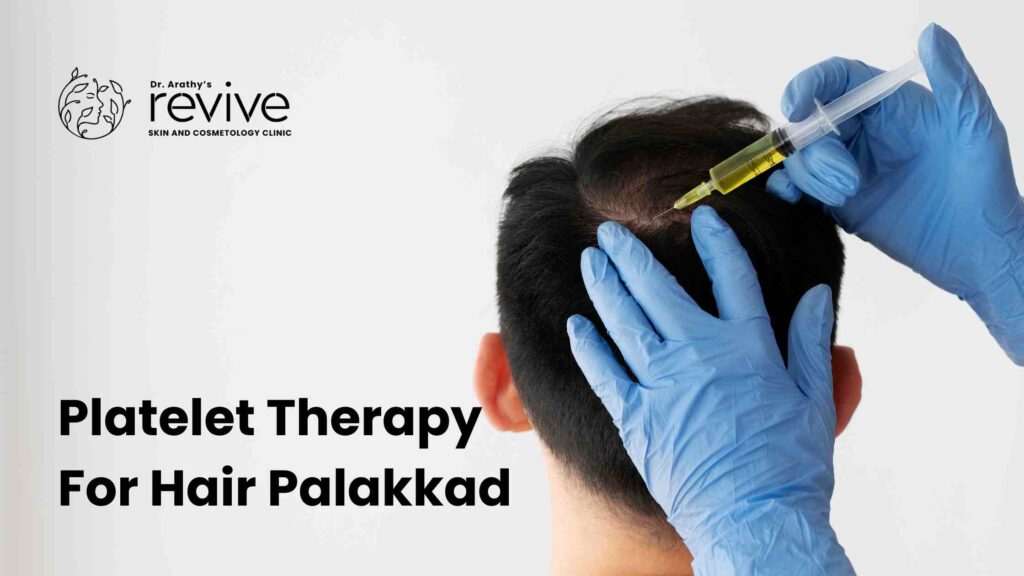 Platelet Therapy For Hair Palakkad