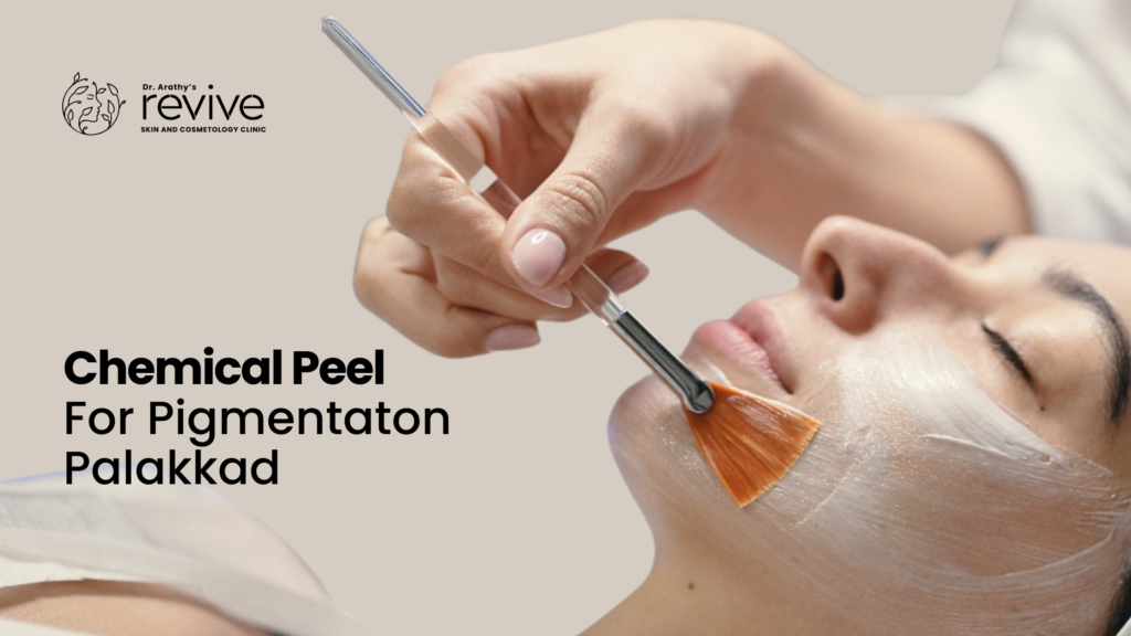 chemical peel for pigmentation Palakkad