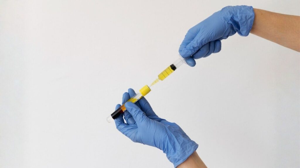 What are the steps of the PRP procedure