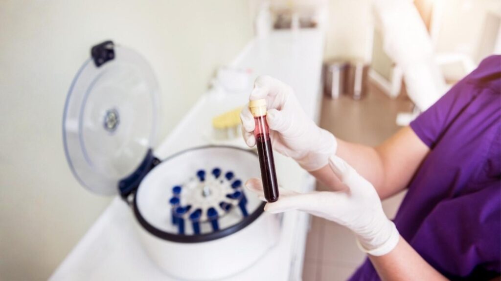 What are the steps of the PRP procedure