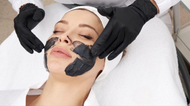 Carbon Laser Peel treatment
