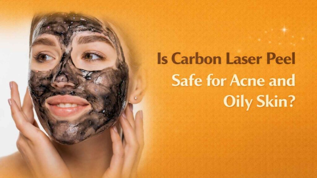 Woman with carbon mask during carbon laser peel treatment for acne and oily skin