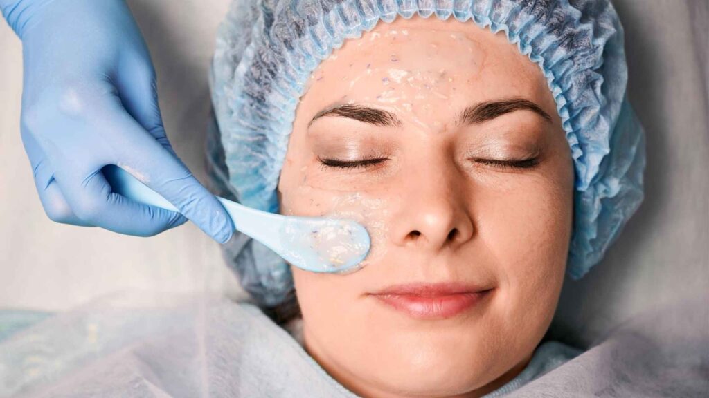 Chemical Peel Procedure Steps in Palakkad showing a dermatologist applying a peel solution on a patient’s face