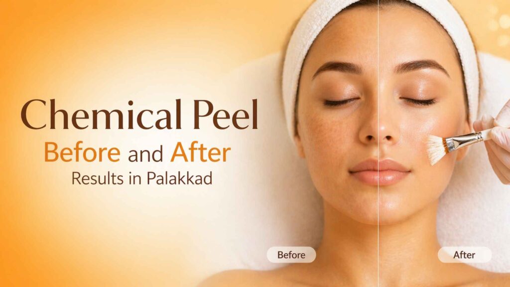 Chemical Peel Before and After Results in Palakkad showing smooth glowing skin improvement after treatment