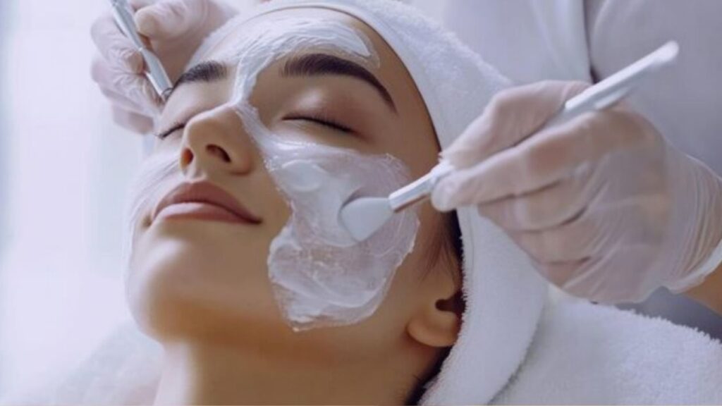 chemical peel treatment