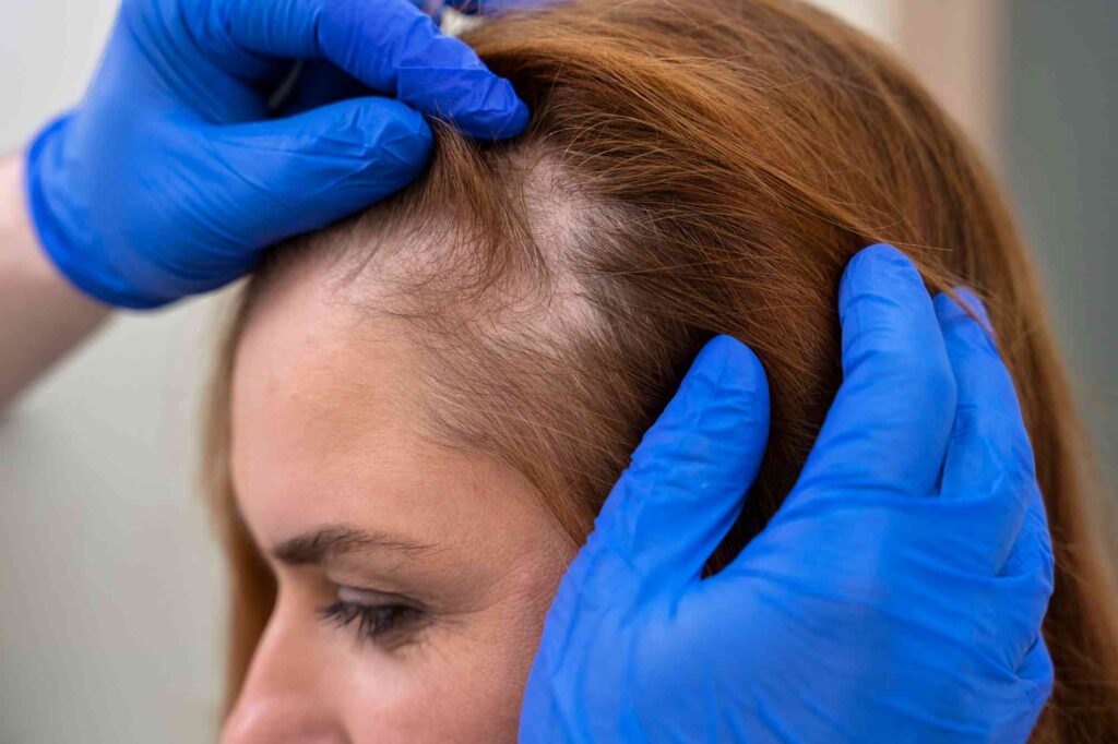 Hair Fall Treatment in Palakkad – dermatologist examining scalp hair loss condition during consultation