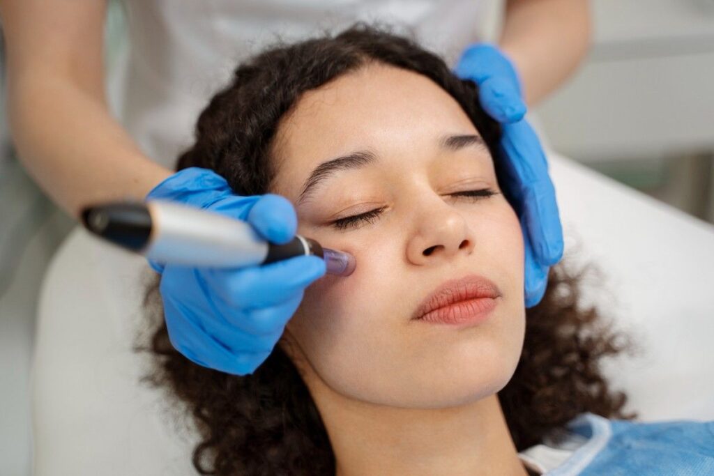 Patient undergoing a Microneedling Procedure on the face during a professional skin rejuvenation treatment session.