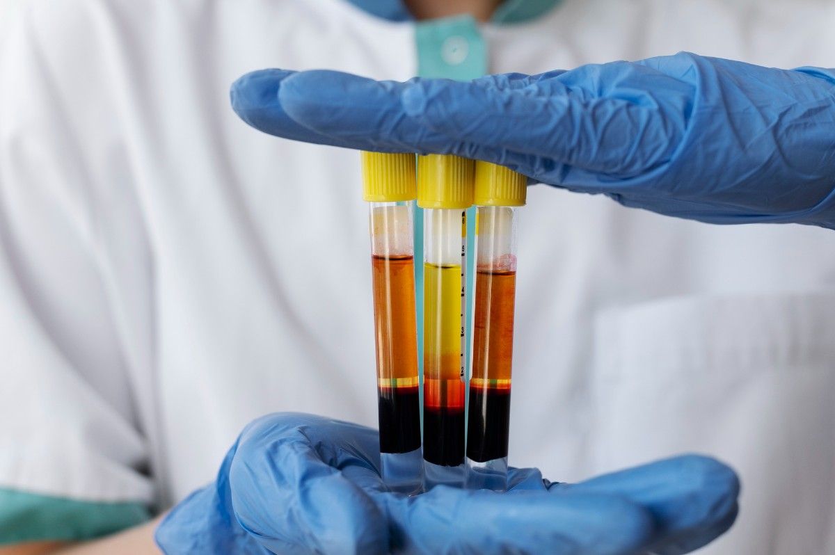 PRP tube and blood preparation
